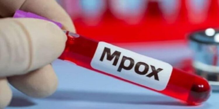 चीनमा एमपक्स स्ट्रेनका पाँच जना नयाँ सङ्क्रमित फेला