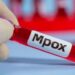 चीनमा एमपक्स स्ट्रेनका पाँच जना नयाँ सङ्क्रमित फेला