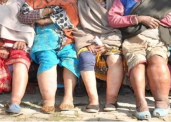 दाङमा भेटिए हात्तीपाइलेका बिरामी