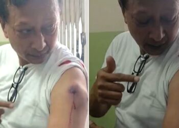 नयाँबानेश्वरमा प्रहरीको गोली कान्तिपुर टिभीका पत्रकार श्याम श्रेष्ठ घाइते