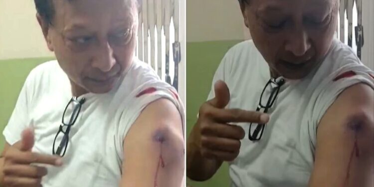 नयाँबानेश्वरमा प्रहरीको गोली कान्तिपुर टिभीका पत्रकार श्याम श्रेष्ठ घाइते