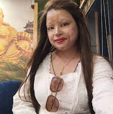 सांसदको हैसियत सकिए पनि जनसेवामा निरन्तर लागिरहने प्रतिवद्धता बिन्दबासिनी कंसाकार